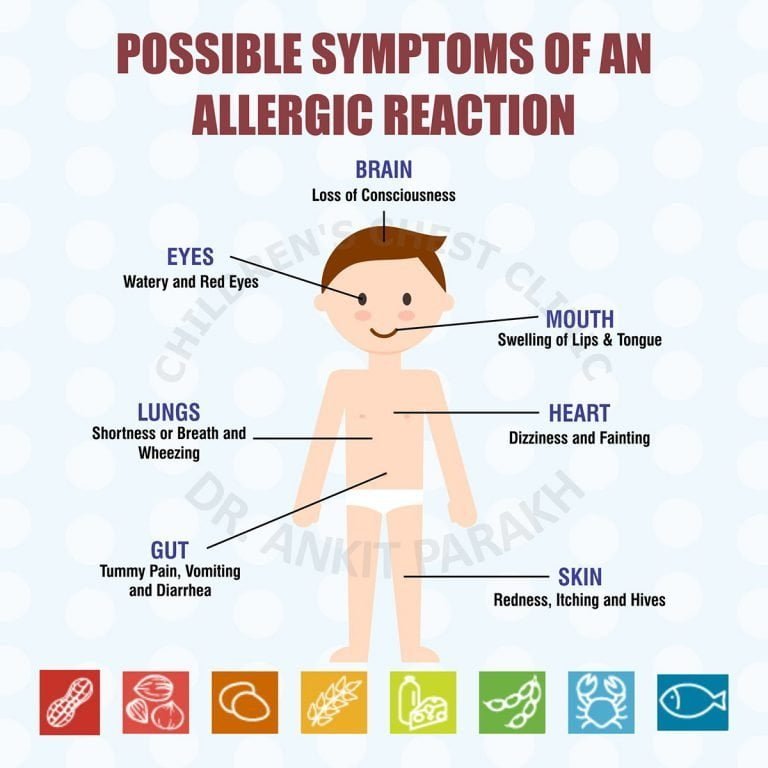 Symptoms of Tree Nut Allergy