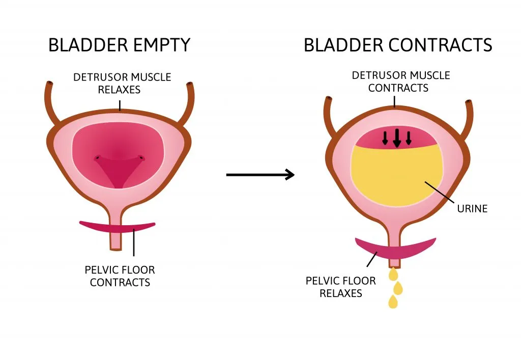 Bladder Dysfunction