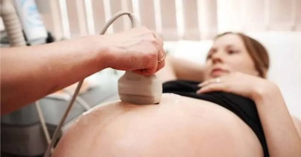 Ultrasound Accuracy